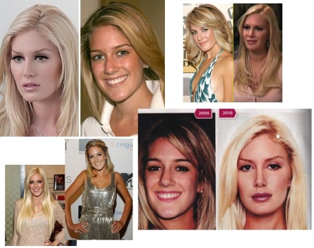 From Heidi to Barbie Pratt